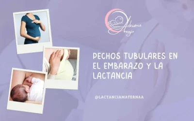 #1 Pechos Tubulares en el Embarazo y la Lactancia